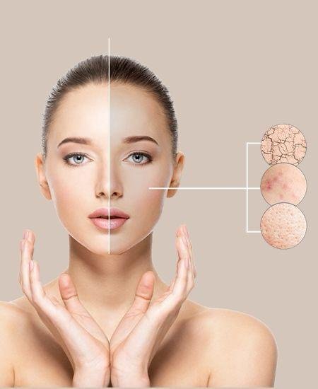 التحكم بالبشرة